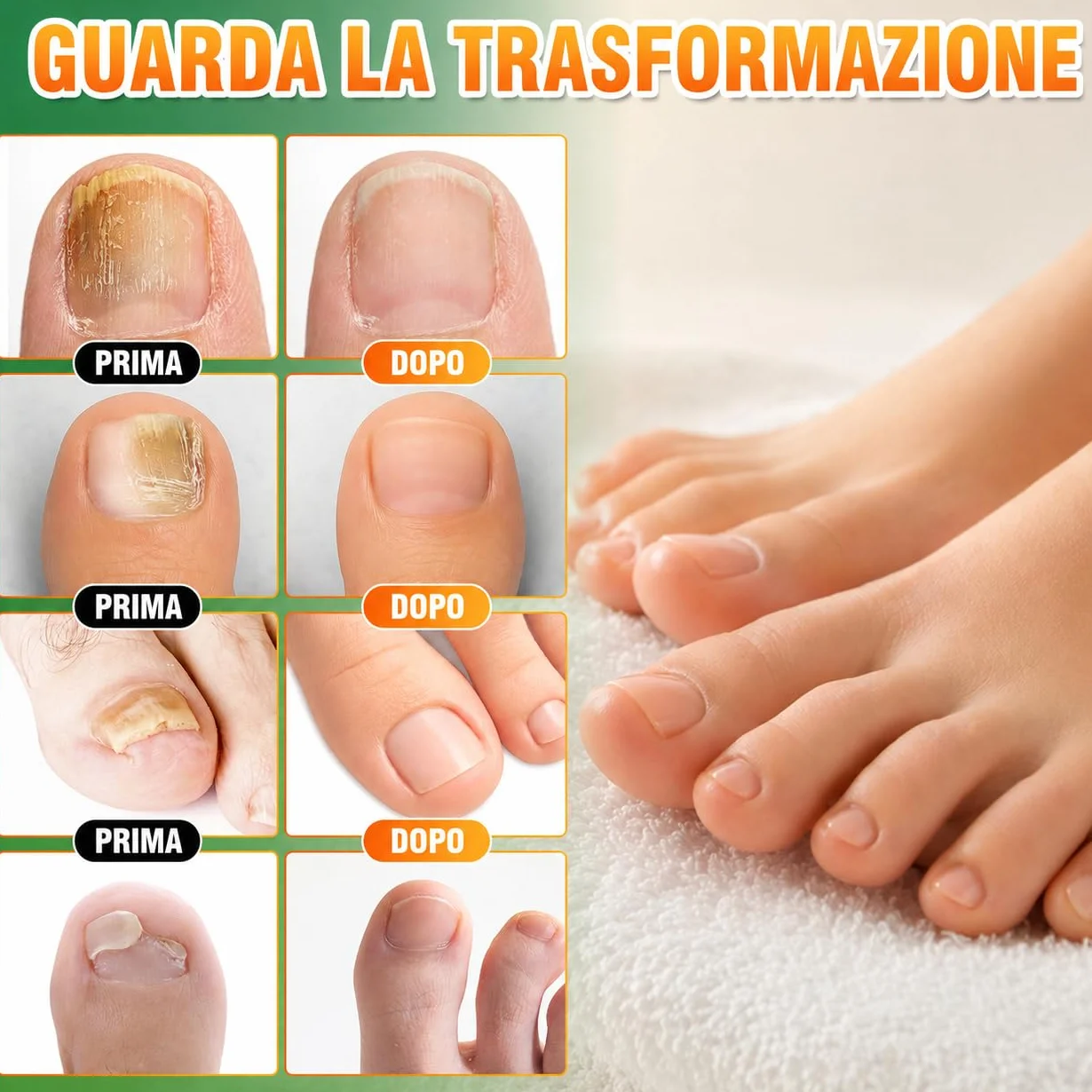 Micosi Unghie Piede Trattamento, Trattamento Funghi Unghie Piedi, Antimicotico Unghie Piedi Liquido, Migliora Unghie Spesse, Fragili, Rotte e Scolorite, Trattamento Rigenerante per Crescita Unghie