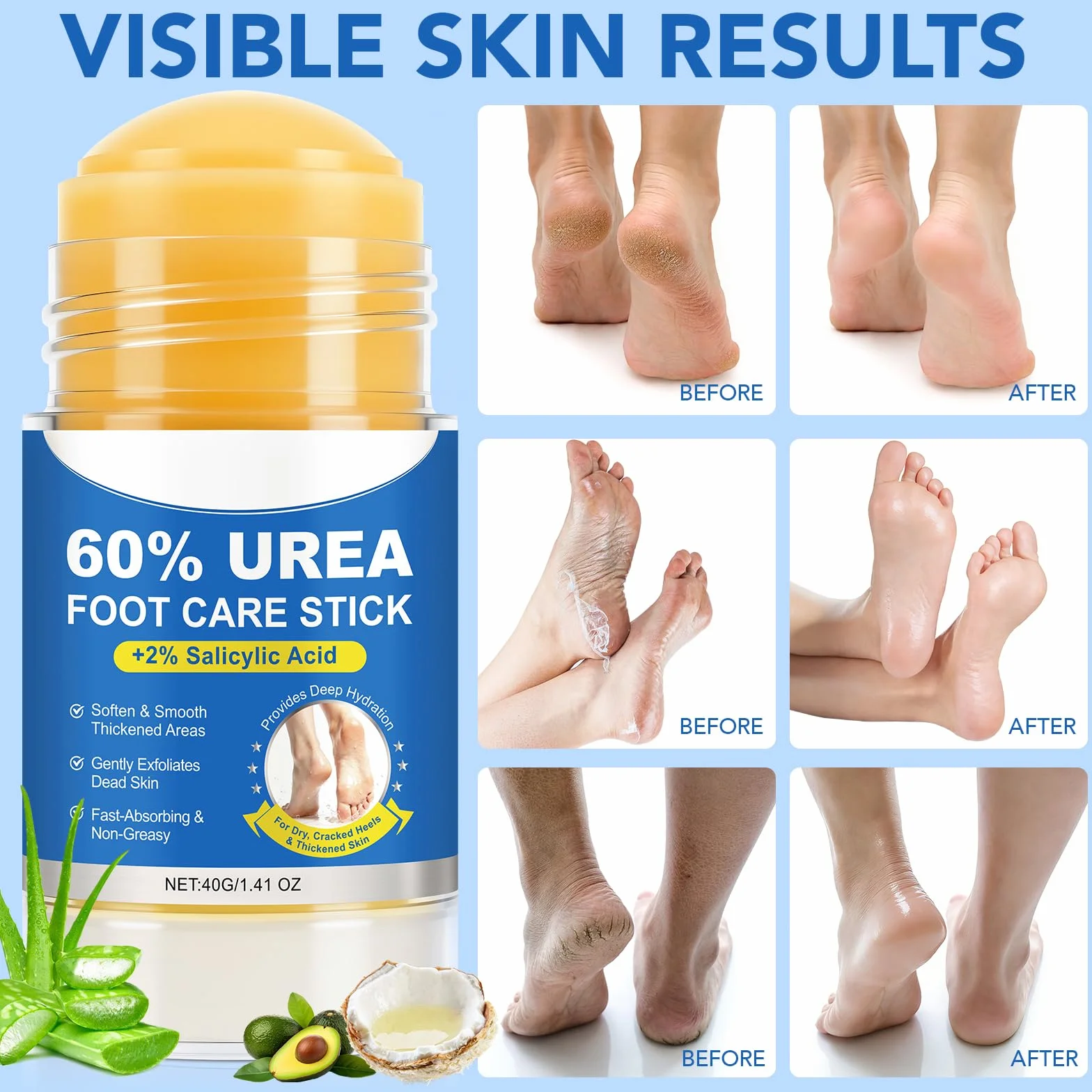 Crema Piedi Urea 60% 40g (2 Pezzi) Idratazione Profonda Pelle Ruvida