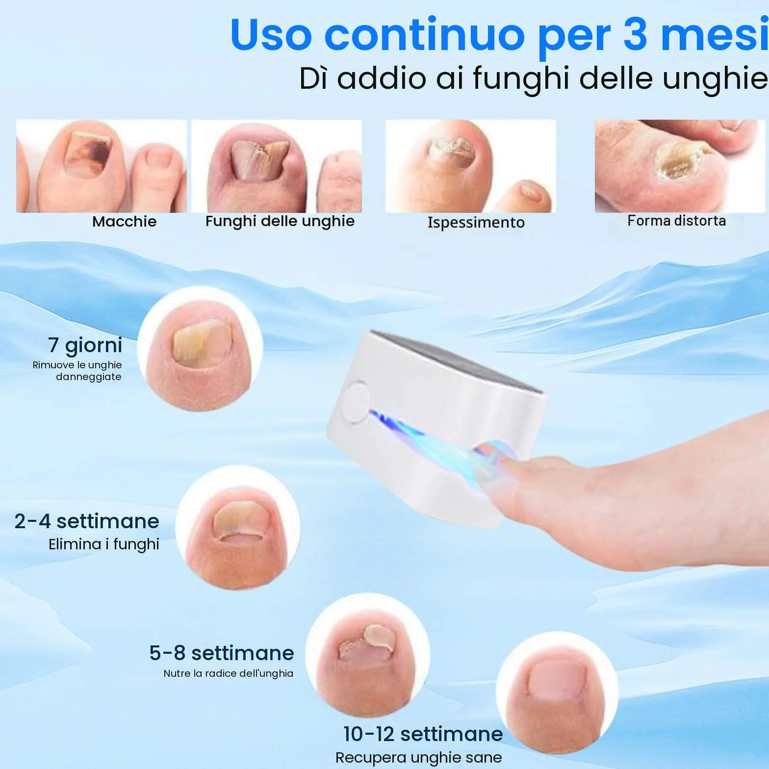 Mycose delle Unghie Laser, Mycose delle Unghie dei Piedi Pulizia e Riparazione Unghie, Dispositivo Trattamento Laser per Micosi delle Unghie dei Piedi, 7 Min al Giorno per Migliorare la Micosi Fungosa