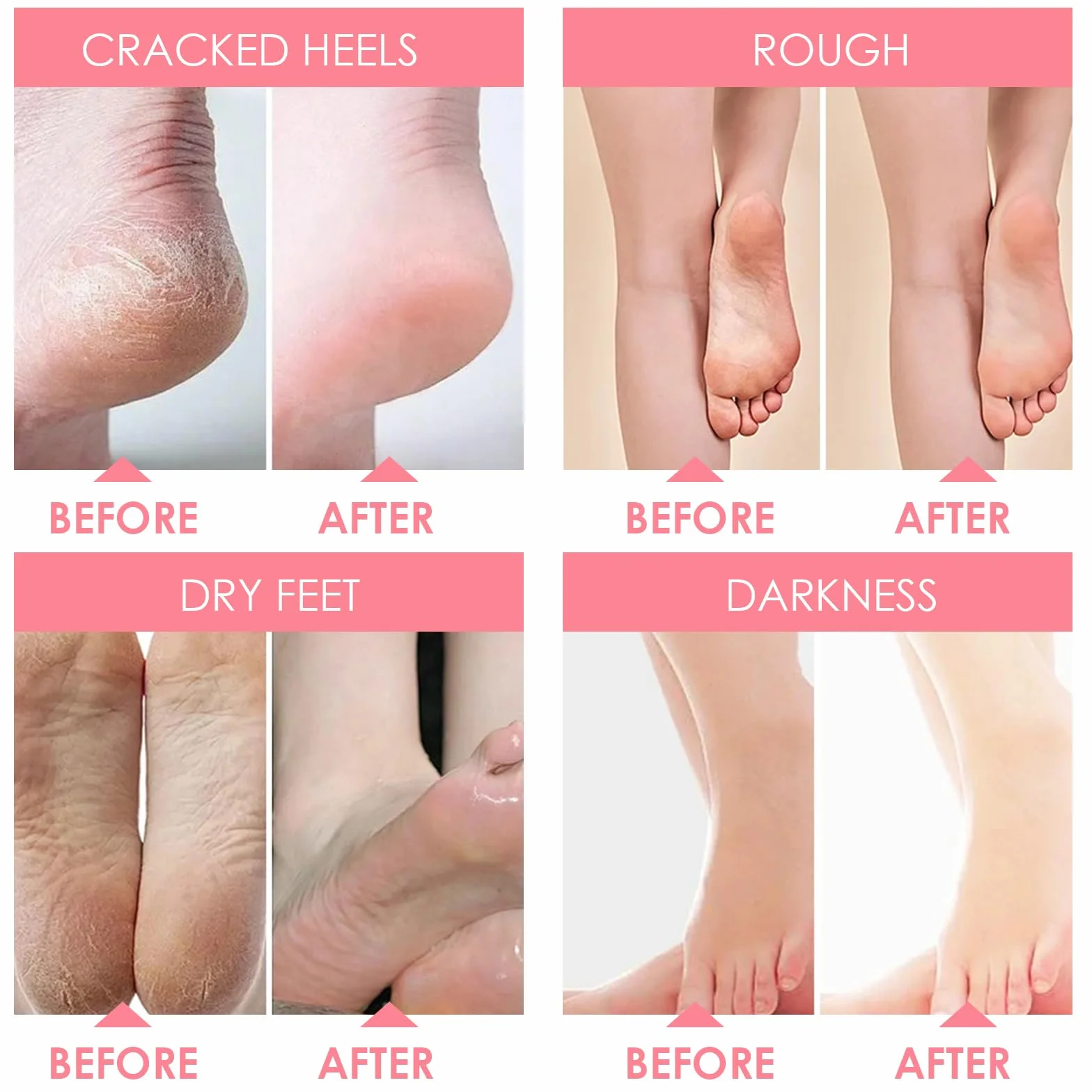 2 Paia Maschera Piedi Esfoliante,Maschera per Piedi Efficace Cura dei Piedi i Scrub Piedi,Maschera Esfoliante Piedi per Donne e Uomini,Rimuove Pelle Morta e Secca（ Fragola Pesca）