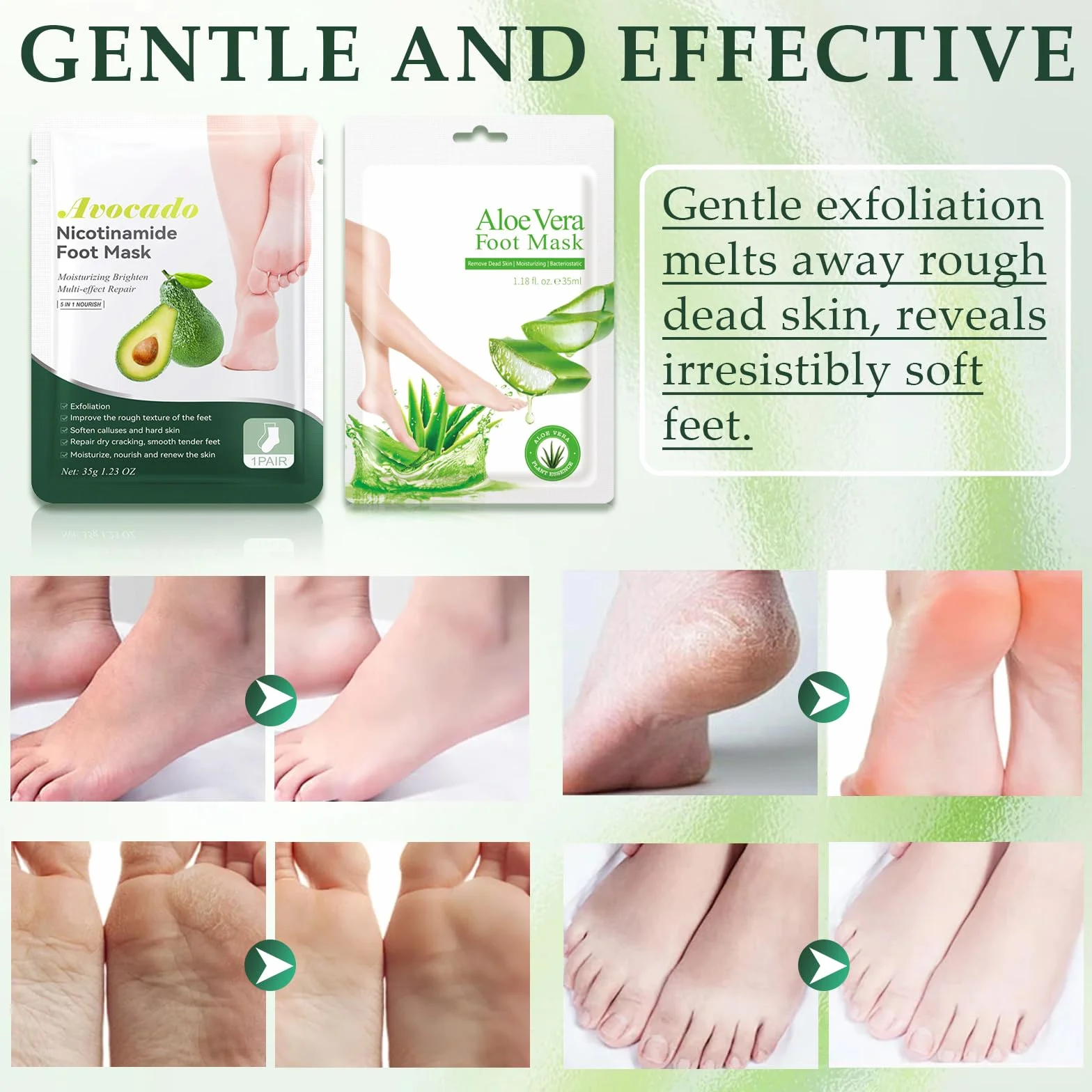 Maschera Piedi Idratante Esfoliante con Aloe Vera e Avocado per Calli e Pelle Morta